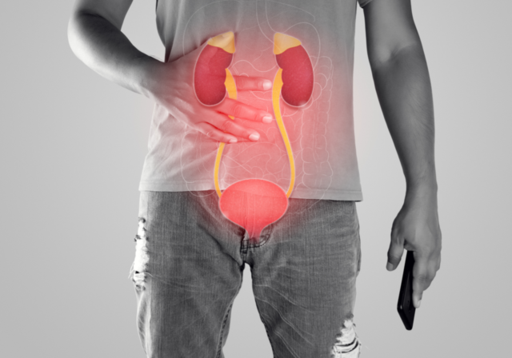 KidneyStone dr abhijit.png